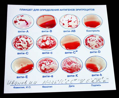 индикаторы для определения остатков крови
